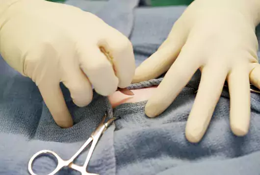 Initial incision for a spay surgery